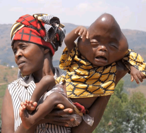 Dad calls his deformed baby 'devil spawn' and tells wife to kill him 3 612960c2b8152