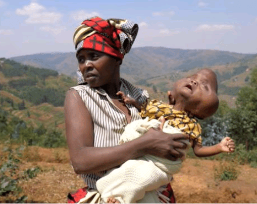 Dad calls his deformed baby 'devil spawn' and tells wife to kill him 4 612965573200f