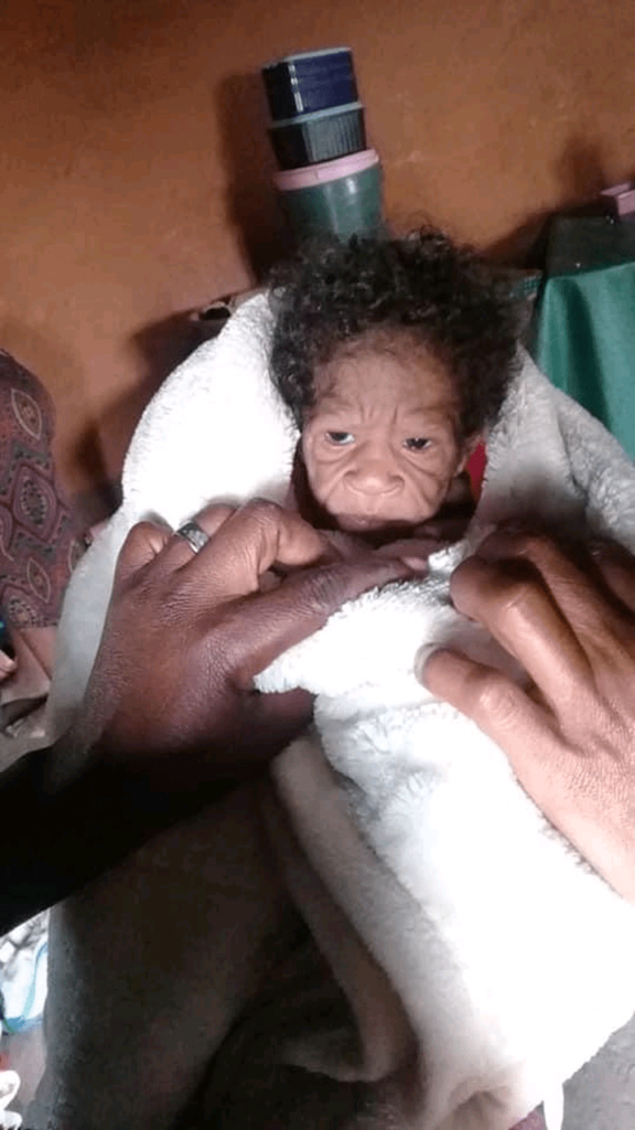 Shocking: A 20-year-old woman from Eastern Cape gave birth to an 80-year-old baby girl 3 80 year old baby