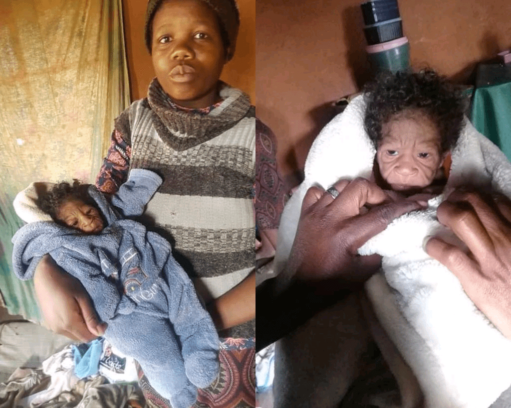 Shocking: A 20-year-old woman from Eastern Cape gave birth to an 80-year-old baby girl 2 Polish 20210828 172354927 1024x8191 1