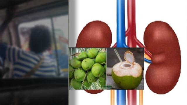 A Female Coconut seller puts her Kidney on sale to feed her poor family 2 Kidney