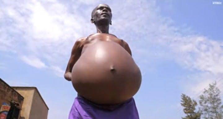 The Story Of Joseph, The Pregnant Man Who Saw Death Face To Face. 4 His friends who were with him in time of enjoyment all have abandoned him when he needed them most. This has become very devastating for him.