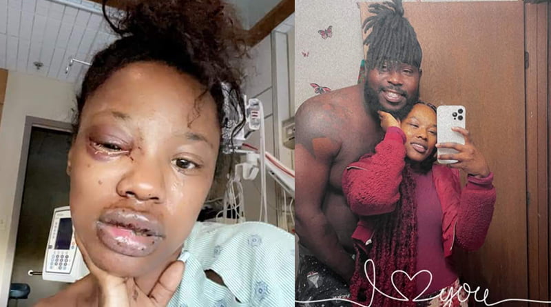 “I Still Love Him, No Man Is Perfect” — Lady Says After Her Boyfriend Did This To Her 2 Lady