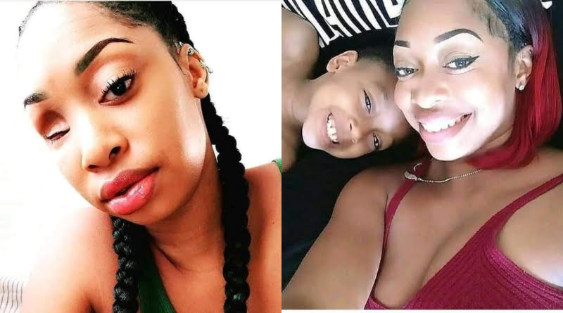 Fine lady narrates how her brother stabbed her five times and lost one of her eyes 2 Fine lady narrates how her brother stabbed her five times and lost one of her eyes