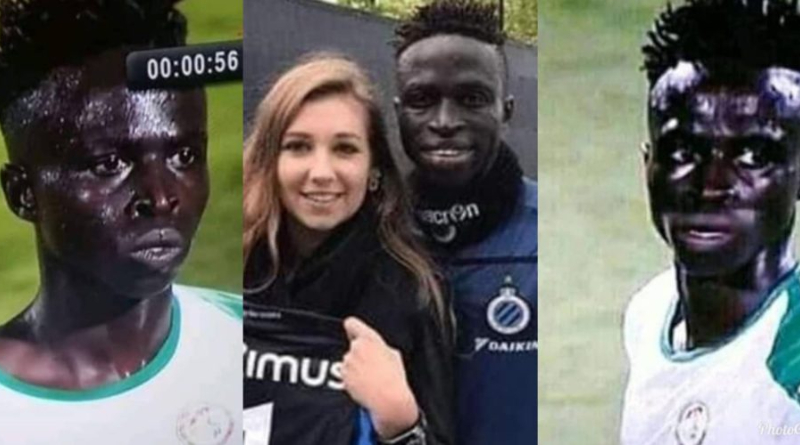 Krepin Diatta Hits Back At Fellow Africans Who Mocked His Physical Look During The Past African Cup. 2 Krepin Diatta