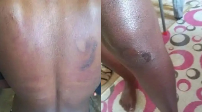 Miss Commonwealth Ghana Finalist Beaten With Cutlass By Juju Man (Details) 2 Miss Commonwealth Ghana Finalist Beaten
