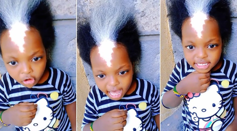 Little Girl With Unique Shiny Birthmark And White Frontal Hairs Goes Viral (Video) 5 Little Girl With Unique Shiny Birthmark And White Frontal Hairs Goes Viral