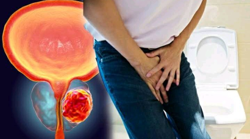 Prostate Cancer: Stop Eating These Foods in Excess 2 Prostate Cancer