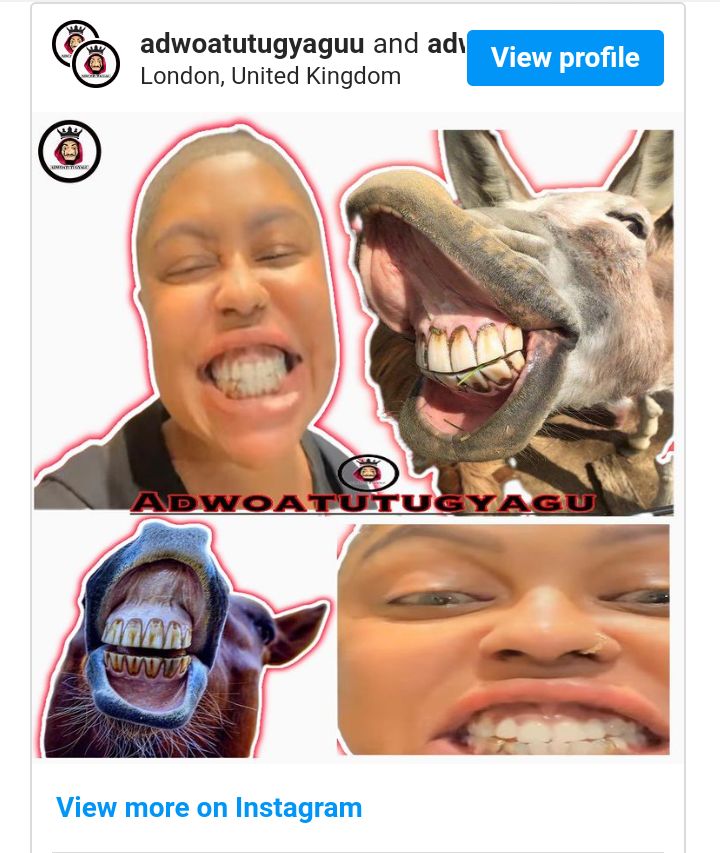 Afia Schwarzenegger Scoffed After Flaunting Her Recently Fixed Teeth 3 Screenshot 20221126 1333032