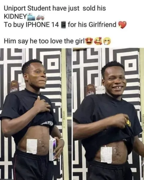 University student sells kidney to buy latest iPhone for his girlfriend 3 kidney for sale