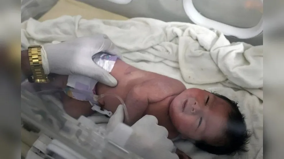 Turkey earthquake; Newborn baby under rubble rescued;safe in the hospital 2 GridArt 20230209 030039500