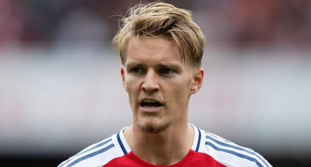 Odegaard expected to be out for a while - Mikel Arteta 2 Odegaard expected to be out for a while - Mikel Arteta