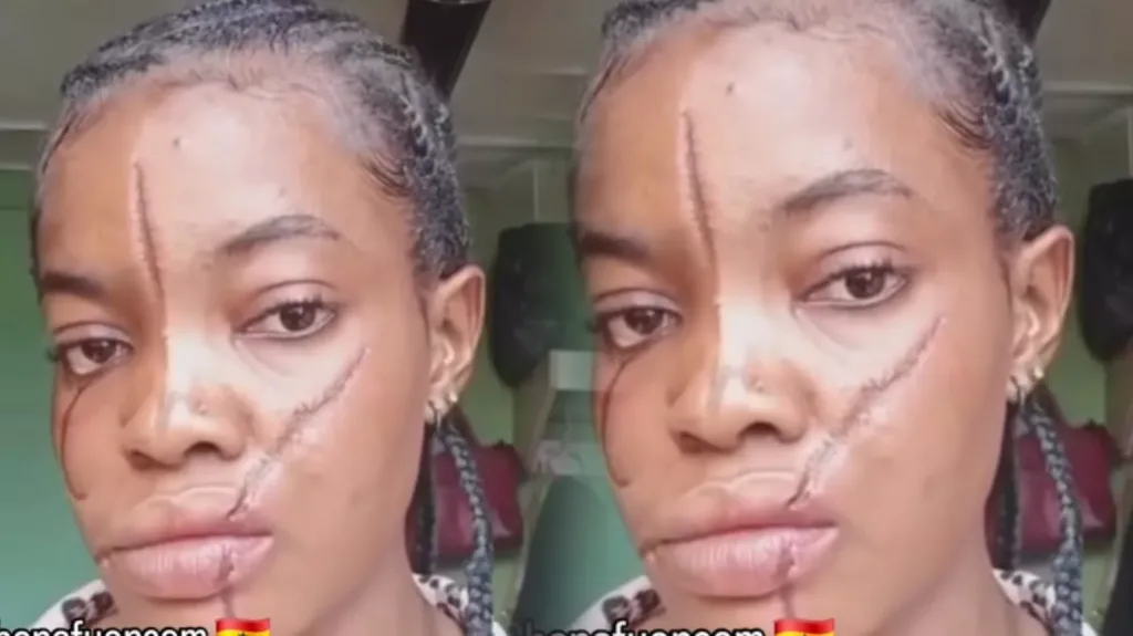 She Gave Me Tribal Marks for Loving Her Man – Lady Tells Her Painful Story 5 She Gave Me Tribal Marks for Loving Her Man – Lady Tells Her Painful Story